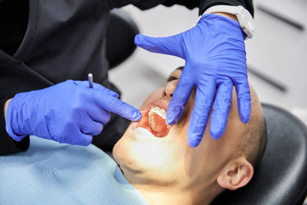 Best Broken or Cracked Tooth Emergency Dentist in Lincroft, NJ